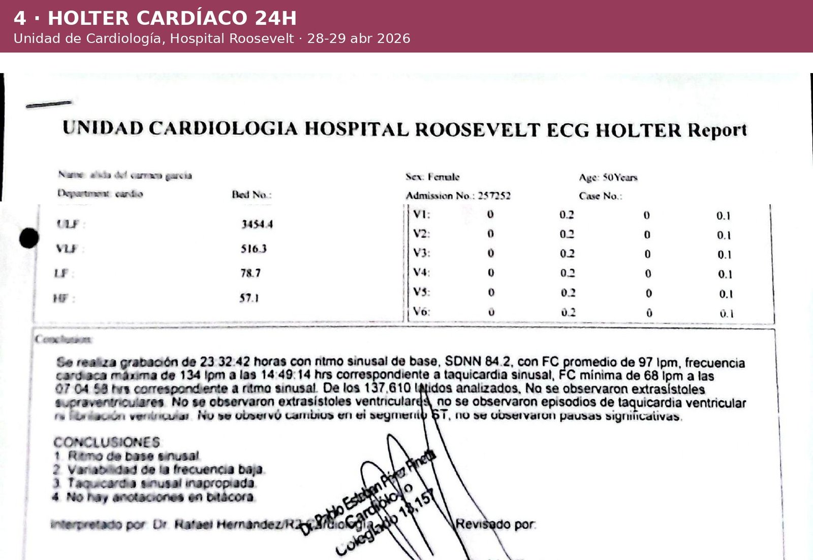 Holter cardíaco de 24 horas