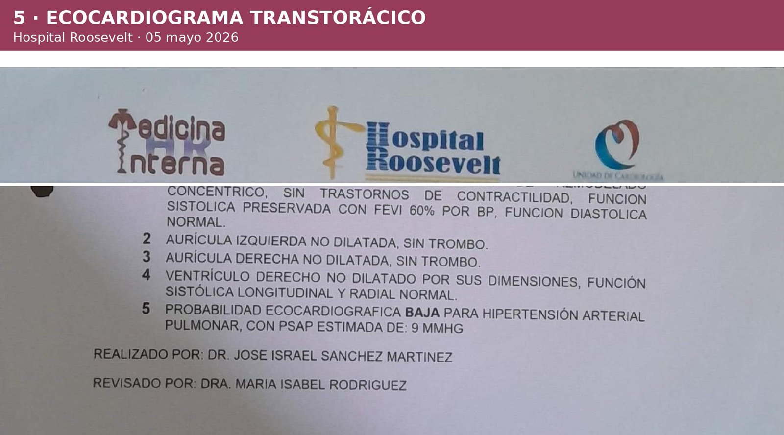 Ecocardiograma